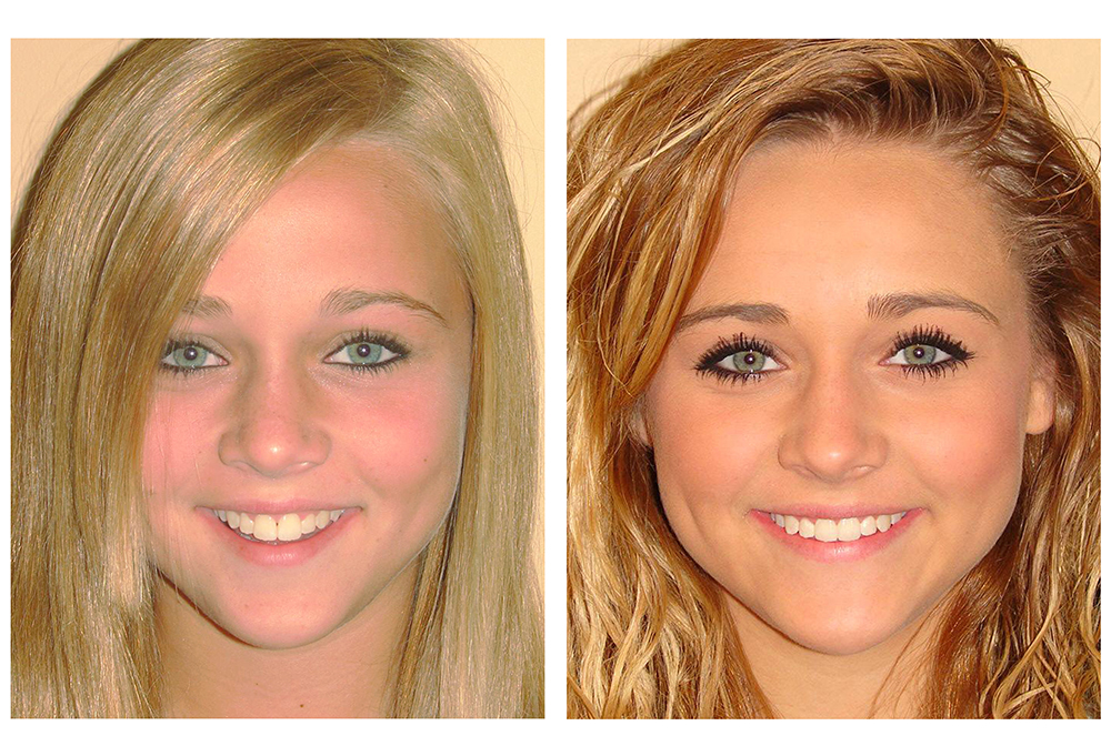 Commack Dental Associates