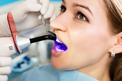 Woman receiving dental treatment with blue light device, likely for teeth whitening, in dentist s office.