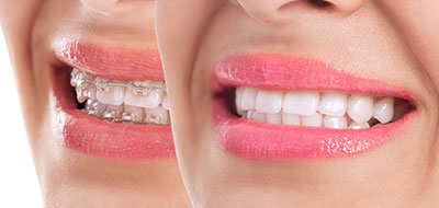 The image displays a close-up of a person s smiling face with pink lipstick, emphasizing their teeth, which are also pink.