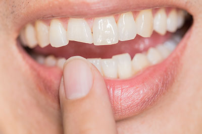 The image shows a close-up of a person s smiling mouth with teeth, holding a finger near their teeth.