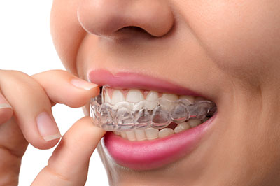 An adult female with a broad smile is holding a toothbrush close to her mouth, showing off a set of white braces.