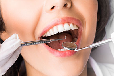 A woman with her mouth wide open, revealing teeth cleaning instruments being used by a dental professional, who appears to be a dentist.