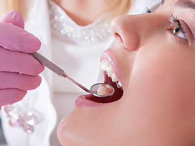 A woman undergoing dental treatment, with a dentist using a drill on her teeth.